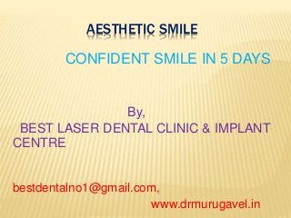 AESTHETIC SMILE
CONFIDENT SMILE IN 5 DAYS
By,
BEST LASER DENTAL CLINIC & IMPLANT
CENTRE
bestdentalno1@gmail.com,
www.drmurugavel.in
 