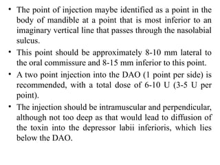 Two Point Injection Comprehensive Guide to Aesthetic Uses of Botulinum Toxin in Facial ...