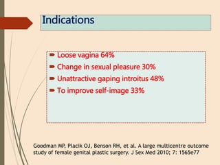 Indications
 Loose vagina 64%
 Change in sexual pleasure 30%
 Unattractive gaping introitus 48%
 To improve self-image 33%
Goodman MP, Placik OJ, Benson RH, et al. A large multicentre outcome
study of female genital plastic surgery. J Sex Med 2010; 7: 1565e77
 