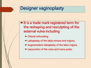 Designer vaginoplasty
It is a trade mark registered term for
the reshaping and resculpting of the
external vulva including
 Clitoral unhooding.
 Labiaplasty of the labia minora and majora,
 Augmentation labiaplasty of the labia majora.
 Liposuction of the vulva and mons pubis.
 
