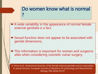 Do women know what is normal
?
 A wide variability in the appearance of normal female
external genitalia is a fact.
 Sexual function does not appear to be associated with
genital dimensions.
 This information is important for women and surgeons
alike when considering cosmetic vulvar surgery.
H. Krissi et al. /Anatomical diversity of the female external genitalia and its association
to sexual function. European Journal of Obstetrics & Gynecology and Reproductive
Biology 196 (2016) 44–47
 