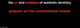 Dr. Paul A. Tipton
the art and science of aesthetic dentistry
prepare ur1 for conventional veneer
 