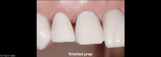 Dr. Paul A. Tipton
finished prep
 