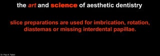 Dr. Paul A. Tipton
the art and science of aesthetic dentistry
slice preparations are used for imbrication, rotation,
diastemas or missing interdental papillae.
 