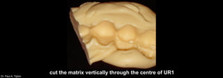 Dr. Paul A. Tipton
cut the matrix vertically through the centre of UR1
 