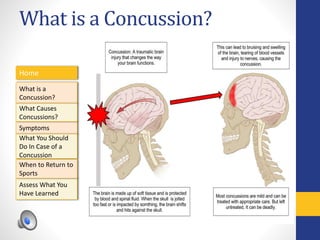 What is a Concussion?
Home
What is a
Concussion?
Symptoms
Assess What You
Have Learned
What Causes
Concussions?
What You Should
Do In Case of a
Concussion
When to Return to
Sports
 