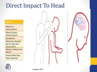 Direct Impact To Head
Home
What is a
Concussion?
Symptoms
Assess What You
Have Learned
What Causes
Concussions?
What You Should
Do In Case of a
Concussion
When to Return to
Sports
LeStage, 2013
 