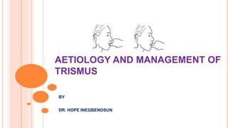 BY
DR. HOPE INEGBENOSUN
AETIOLOGY AND MANAGEMENT OF
TRISMUS
 