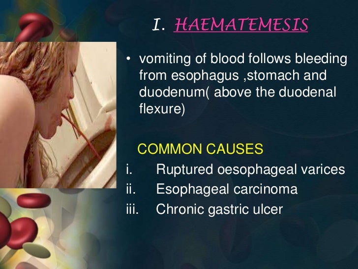 Aetiology of upper gi bleed