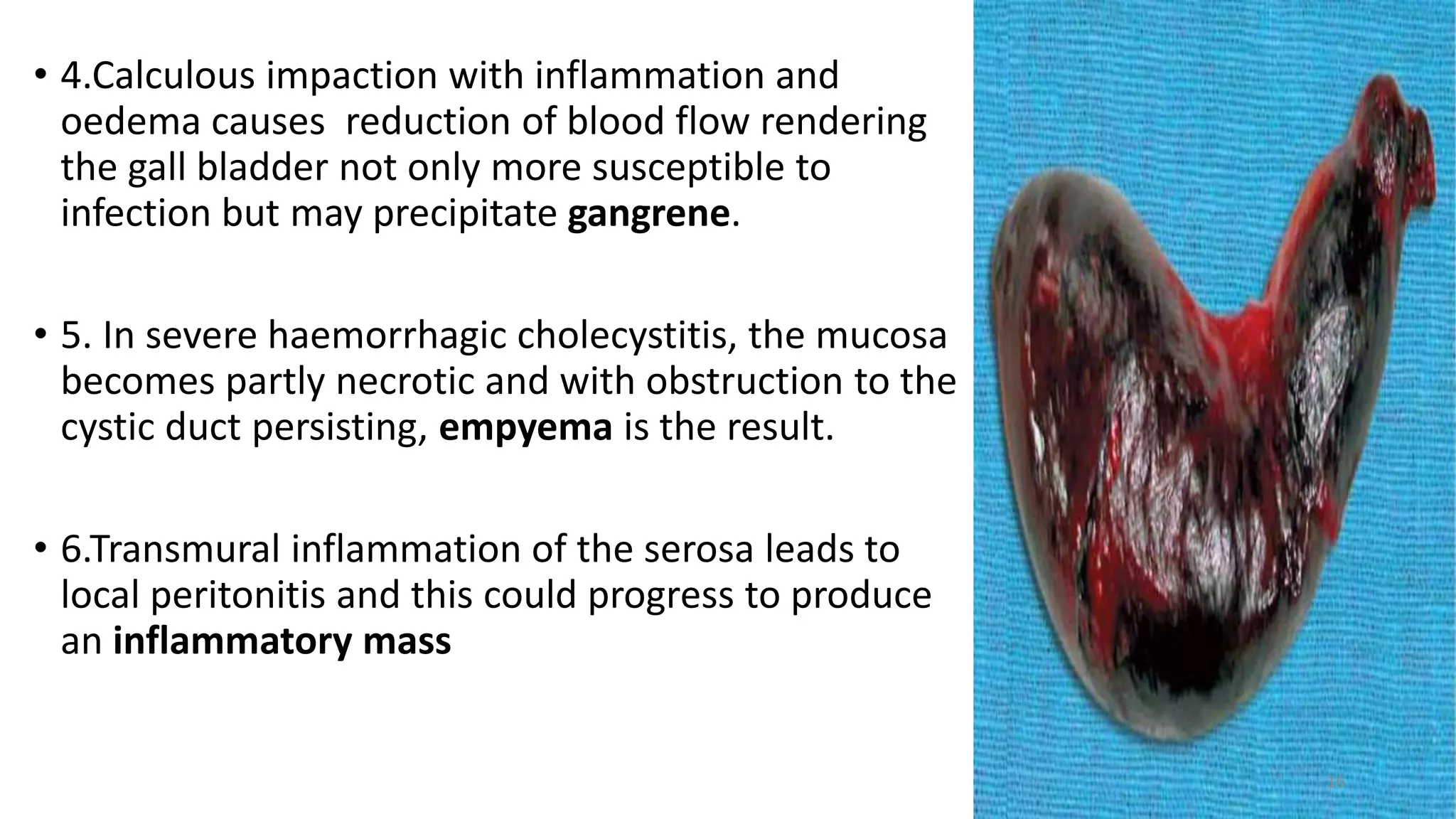 Aetiopathologenesis and management of acute cholecystitis | PDF
