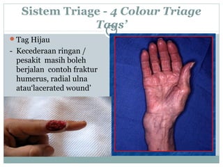 Sistem Triage - 4 Colour Triage
Tags’
Tag Hijau
- Kecederaan ringan /
pesakit masih boleh
berjalan contoh fraktur
humerus, radial ulna
atau‘lacerated wound’
 