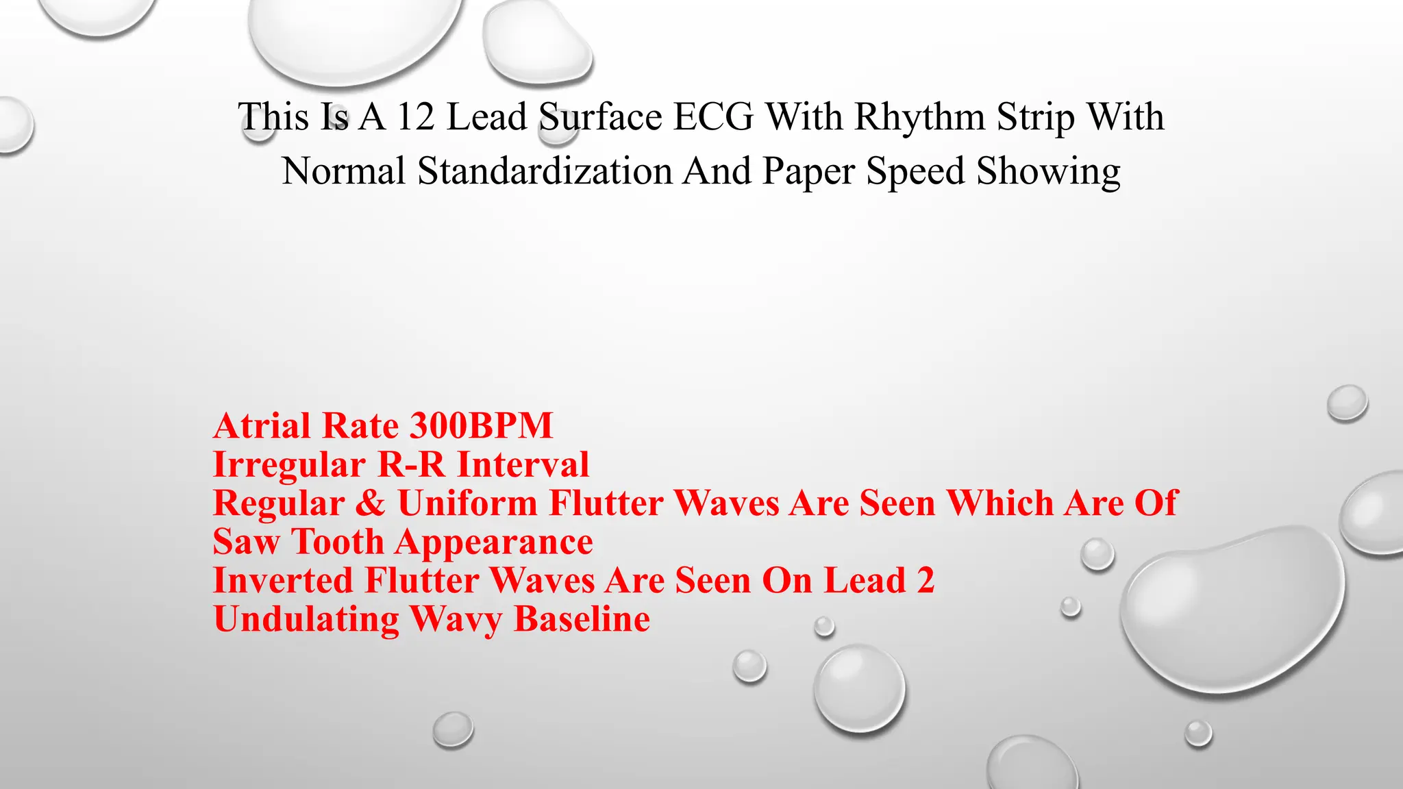 Is The Rto R Regular In A Flutter Atrial fibrillation & atrial flutter.pptx