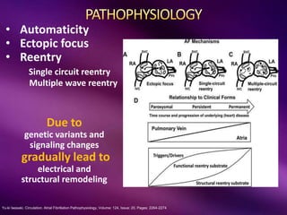 Yu-ki Iwasaki. Circulation. Atrial Fibrillation Pathophysiology, Volume: 124, Issue: 20, Pages: 2264-2274
• Automaticity
• Ectopic focus
• Reentry
Single circuit reentry
Multiple wave reentry
Due to
genetic variants and
signaling changes
gradually lead to
electrical and
structural remodeling
 