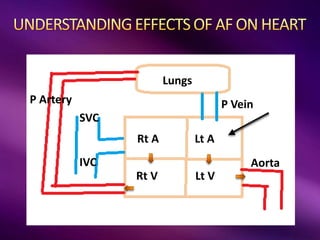 SVC
IVC
P Artery P Vein
Aorta
Lungs
Lt A
Rt A
Rt V Lt V
 