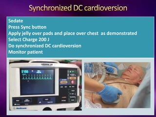 Sedate
Press Sync button
Apply jelly over pads and place over chest as demonstrated
Select Charge 200 J
Do synchronized DC cardioversion
Monitor patient
 