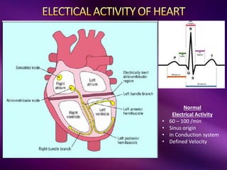 LEFT ATRIA
Normal
Electrical Activity
• 60 – 100 /min
• Sinus origin
• In Conduction system
• Defined Velocity
 