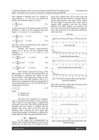 S. Thulasi Prasad et al Int. Journal of Engineering Research and Applications
ISSN : 2248-9622, Vol. 4, Issue 1( Version 3), January 2014, pp.186-190
these subbands in different ways. For example by
using subbands 1, 2, 3 and 4 we can calculate the
feature sum-of-absolute values, P1, as [15]:
4

P1 

Z

k

( z)

(11)

k 1

P1 gives the energy in the frequency band [4, 28] Hz.
Similarly, P2 and P3 can be computed using subbands {1, 2, 3}, and {2, 3, 4}, respectively as:
P2 

Z

k

( z)

k  1,2,3

( z)

k  1,3,4

noises that resulted from 50 Hz power lines and
baseline drift and then filtered in a lowpass filter to
remove high frequency noise above 60 Hz. Finally
the ECG signal is processed with a filter bank to
separate QRS complexes and then the R-peak
positions from QRS complex were detected. The
Fig.5 shows the noisy ECG signal and its spectrum,
ECG after removing 50 Hz powerline interference
and its spectrum.

(12)

k

www.ijera.com

(13)

k

P3 

Z
k

And these values are proportional to the energy in
their respective sub-bands.
Similarly the features mean-of-sum-ofsquares P4, P5 and P6 can be computed using
subbands {1, 2, 3, 4}, {1, 2, 3} and {2, 3, 4},
respectively as:
1
Z k ( z) 2
(14)
P4 
k  1,2,3,4
4 k



P5 
P6 

1
3

 Z

1
3

 Z

k ( z)

2

k  1,2,3

(15)

k ( z)

2

k  1,2,3,4

(16)

k

k

These features represent the energy of the
QRS complex. An heuristic beat detection logic can
be developed to maximize the number of true
positives (TP's), while keeping the number of false
negatives (FN's) and false positives (FP's) to a
minimum by computing the detection strength (D) of
an incoming feature (e.g., P1, P2, P3) with the help of
signal and noise levels as:
PN
D
(17)
SN
Where
S = Signal Level
N= Noise Level

Fig. 5 ECG and its soectrum after removing 50 Hz
powerline interfence
Fig.6 shows the ECG signal after processing with a
filter bank and R-peaks detected.

The value of D is limited at 0 if a feature's
value is less than N and limited to 1when a feature's
value is above S. The signal history is updated with
the feature's value if the value of D is greater than the
threshold and noise history is updated with the
feature's value if the value of D is less than the
threshold. After extracting the ECG signal with
isolated QRS energies, the R-peaks are detected by
simple algorithm where a dynamic threshold is used.

IV.

RESULTS

In this paper first we implemented an
adaptive filter using MATLAB built-in function and
adaptive.lms on input noisy ECG signal to reduce
www.ijera.com

Fig.6 Lowpass filtered ECG and Cleaned ECG with
detected R-peaks

189 | P a g e

 