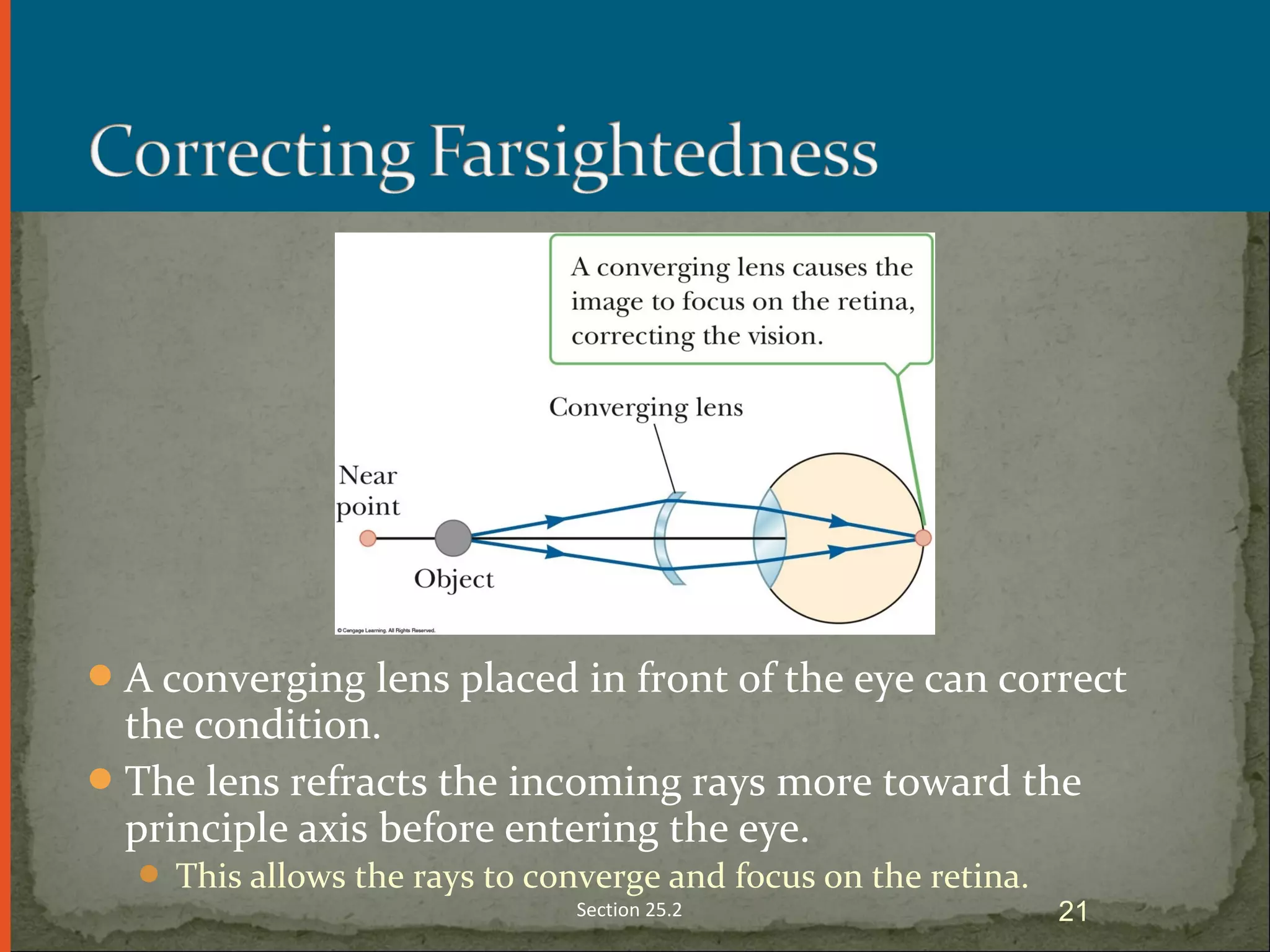 A converging lens placed in front of the eye can correct
the condition.
The lens refracts the incoming rays more toward the
principle axis before entering the eye.
 This allows the rays to converge and focus on the retina.
Section 25.2 21
 