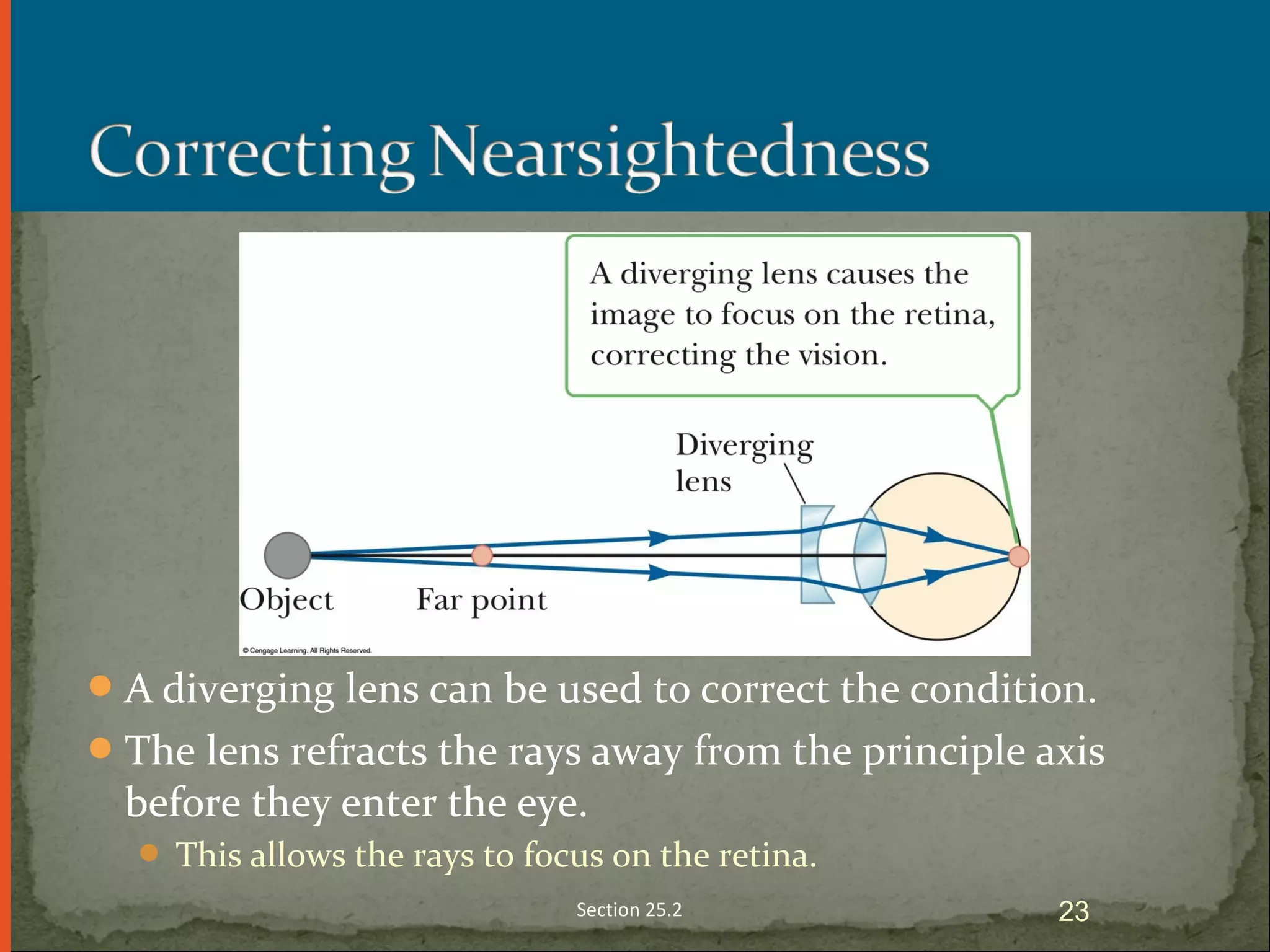 A diverging lens can be used to correct the condition.
The lens refracts the rays away from the principle axis
before they enter the eye.
 This allows the rays to focus on the retina.
Section 25.2 23
 