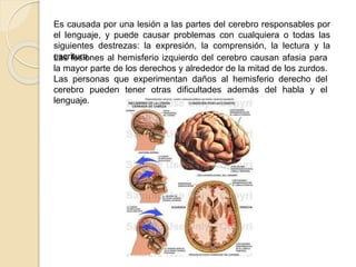 Es causada por una lesión a las partes del cerebro responsables por
el lenguaje, y puede causar problemas con cualquiera o todas las
siguientes destrezas: la expresión, la comprensión, la lectura y la
escritura.Las lesiones al hemisferio izquierdo del cerebro causan afasia para
la mayor parte de los derechos y alrededor de la mitad de los zurdos.
Las personas que experimentan daños al hemisferio derecho del
cerebro pueden tener otras dificultades además del habla y el
lenguaje.
 