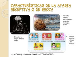 https://www.youtube.com/watch?v=YOfoWu9GNOc
• necesita
tiempo
adicional para
entender
mensajes
orales
• Dificultad en
seguir el habla
rápida.
• Malinter
preta las
sutileza
s del
lenguaje
 