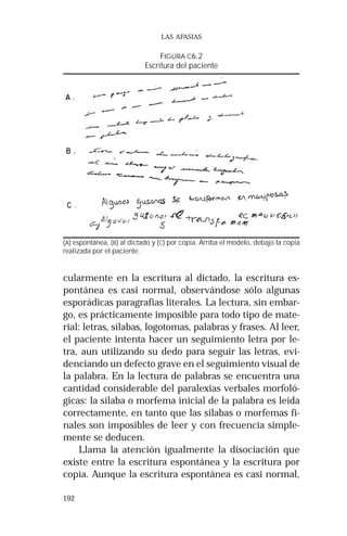192 
LAS AFASIAS 
FIGURA C6.2 
Escritura del paciente 
(A) espontánea, (B) al dictado y (C) por copia. Arriba el modelo, debajo la copia 
realizada por el paciente. 
cularmente en la escritura al dictado, la escritura es-pontánea 
es casi normal, observándose sólo algunas 
esporádicas paragrafias literales. La lectura, sin embar-go, 
es prácticamente imposible para todo tipo de mate-rial: 
letras, sílabas, logotomas, palabras y frases. Al leer, 
el paciente intenta hacer un seguimiento letra por le-tra, 
aun utilizando su dedo para seguir las letras, evi-denciando 
un defecto grave en el seguimiento visual de 
la palabra. En la lectura de palabras se encuentra una 
cantidad considerable del paralexias verbales morfoló-gicas: 
la sílaba o morfema inicial de la palabra es leída 
correctamente, en tanto que las sílabas o morfemas fi-nales 
son imposibles de leer y con frecuencia simple-mente 
se deducen. 
Llama la atención igualmente la disociación que 
existe entre la escritura espontánea y la escritura por 
copia. Aunque la escritura espontánea es casi normal, 
 