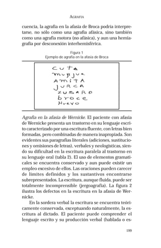 199 
AGRAFIA 
cuencia, la agrafia en la afasia de Broca podría interpre-tarse, 
no sólo como una agrafia afásica, sino también 
como una agrafia motora (no afásica), y aun una hemia-grafia 
por desconexión interhemisférica. 
Figura 1 
Ejemplo de agrafia en la afasia de Broca 
Agrafia en la afasia de Wernicke. El paciente con afasia 
de Wernicke presenta un trastorno en su lenguaje escri-to 
caracterizado por una escritura fluente, con letras bien 
formadas, pero combinadas de manera inapropiada. Son 
evidentes sus paragrafias literales (adiciones, sustitucio-nes 
y omisiones de letras), verbales y neologísticas, sien-do 
su dificultad en la escritura paralela al trastorno en 
su lenguaje oral (tabla 2). El uso de elementos gramati-cales 
se encuentra conservado y aun puede existir un 
empleo excesivo de ellos. Las oraciones pueden carecer 
de límites definidos y los sustantivos encontrarse 
subrepresentados. La escritura, aunque fluida, puede ser 
totalmente incomprensible (jergoagrafia). La figura 2 
ilustra los defectos en la escritura en la afasia de Wer-nicke. 
En la sordera verbal la escritura se encuentra teóri-camente 
conservada, exceptuando naturalmente, la es-critura 
al dictado. El paciente puede comprender el 
lenguaje escrito y su producción verbal (hablada o es- 
 