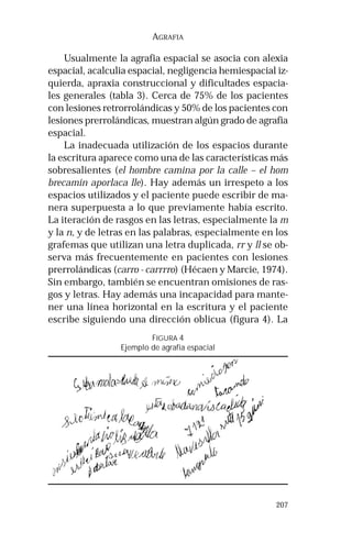 207 
AGRAFIA 
Usualmente la agrafia espacial se asocia con alexia 
espacial, acalculia espacial, negligencia hemiespacial iz-quierda, 
apraxia construccional y dificultades espacia-les 
generales (tabla 3). Cerca de 75% de los pacientes 
con lesiones retrorrolándicas y 50% de los pacientes con 
lesiones prerrolándicas, muestran algún grado de agrafia 
espacial. 
La inadecuada utilización de los espacios durante 
la escritura aparece como una de las características más 
sobresalientes (el hombre camina por la calle – el hom 
brecamin aporlaca lle). Hay además un irrespeto a los 
espacios utilizados y el paciente puede escribir de ma-nera 
superpuesta a lo que previamente había escrito. 
La iteración de rasgos en las letras, especialmente la m 
y la n, y de letras en las palabras, especialmente en los 
grafemas que utilizan una letra duplicada, rr y ll se ob-serva 
más frecuentemente en pacientes con lesiones 
prerrolándicas (carro - carrrro) (Hécaen y Marcie, 1974). 
Sin embargo, también se encuentran omisiones de ras-gos 
y letras. Hay además una incapacidad para mante-ner 
una línea horizontal en la escritura y el paciente 
escribe siguiendo una dirección oblicua (figura 4). La 
FIGURA 4 
Ejemplo de agrafia espacial 
 