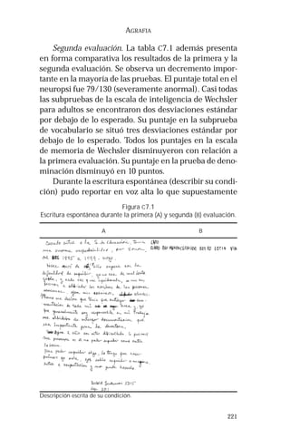 221 
AGRAFIA 
Segunda evaluación. La tabla C7.1 además presenta 
en forma comparativa los resultados de la primera y la 
segunda evaluación. Se observa un decremento impor-tante 
en la mayoría de las pruebas. El puntaje total en el 
neuropsi fue 79/130 (severamente anormal). Casi todas 
las subpruebas de la escala de inteligencia de Wechsler 
para adultos se encontraron dos desviaciones estándar 
por debajo de lo esperado. Su puntaje en la subprueba 
de vocabulario se situó tres desviaciones estándar por 
debajo de lo esperado. Todos los puntajes en la escala 
de memoria de Wechsler disminuyeron con relación a 
la primera evaluación. Su puntaje en la prueba de deno-minación 
disminuyó en 10 puntos. 
Durante la escritura espontánea (describir su condi-ción) 
pudo reportar en voz alta lo que supuestamente 
Figura C7.1 
Escritura espontánea durante la primera (A) y segunda (B) evaluación. 
A B 
Descripción escrita de su condición. 
 