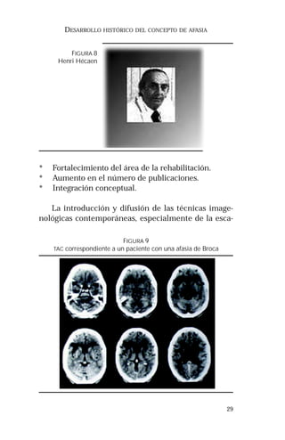 29 
DESARROLLO HISTÓRICO DEL CONCEPTO DE AFASIA 
FIGURA 8 
Henri Hécaen 
* Fortalecimiento del área de la rehabilitación. 
* Aumento en el número de publicaciones. 
* Integración conceptual. 
La introducción y difusión de las técnicas image-nológicas 
contemporáneas, especialmente de la esca- 
FIGURA 9 
TAC correspondiente a un paciente con una afasia de Broca 
 