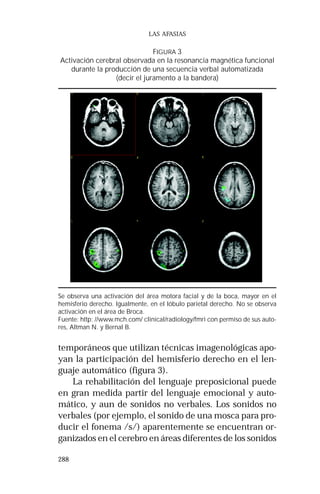 Se observa una activación del área motora facial y de la boca, mayor en el 
hemisferio derecho. Igualmente, en el lóbulo parietal derecho. No se observa 
activación en el área de Broca. 
Fuente: http: //www.mch.com/ clinical/radiology/fmri con permiso de sus auto-res, 
288 
LAS AFASIAS 
FIGURA 3 
Activación cerebral observada en la resonancia magnética funcional 
durante la producción de una secuencia verbal automatizada 
(decir el juramento a la bandera) 
Altman N. y Bernal B. 
temporáneos que utilizan técnicas imagenológicas apo-yan 
la participación del hemisferio derecho en el len-guaje 
automático (figura 3). 
La rehabilitación del lenguaje preposicional puede 
en gran medida partir del lenguaje emocional y auto-mático, 
y aun de sonidos no verbales. Los sonidos no 
verbales (por ejemplo, el sonido de una mosca para pro-ducir 
el fonema /s/) aparentemente se encuentran or-ganizados 
en el cerebro en áreas diferentes de los sonidos 
 
