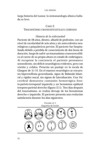 72 
LAS AFASIAS 
larga historia del tumor, la sintomatología afásica halla-da 
es leve. 
CASO 2: 
TRAUMATISMO CRANEOENCEFÁLICO CERRADO 
Historia de la enfermedad 
Paciente de 28 años, diestro, albañil de profesión, con un 
nivel de escolaridad de seis años y sin antecedentes neu-rológicos 
o psiquiátricos previos. El paciente fue hospita-lizado 
debido a pérdida de conocimiento de dos horas de 
duración, luego de sufrir un traumatismo craneoencefáli-co 
al caerse de su propia altura en estado de embriaguez. 
Al recuperar la conciencia el paciente permanece 
somnoliento, sin déficit neurológicos evidentes, pero con 
vómito y cefalea. Presenta un puntaje en la escala de 
Glasgow de 11/15. En el examen neurológico se encuen-tra 
hiperrreflexia generalizada, signo de Babinski bilate-ral 
y rigidez nucal, sin signos de lateralización. Una TAC 
cerebral demuestra contusión hemorrágica fron-to- 
parieto-termporal izquierda y un hematoma epidural 
temporo-parietal derecho (figura C2.1). Tres días después 
del traumatismo, se realiza drenaje de los hematomas 
derecho e izquierdo. El paciente presenta una evolución 
satisfactoria durante los días siguientes. 
FIGURA C2.1 
Esquema de lesión 
 