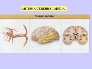 ARTÉRIA CEREBRAL MÉDIA 