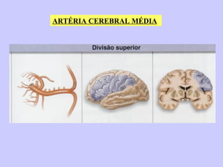 ARTÉRIA CEREBRAL MÉDIA 