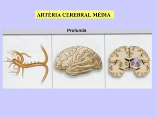 ARTÉRIA CEREBRAL MÉDIA 