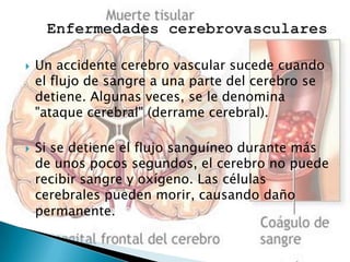 



Un accidente cerebro vascular sucede cuando
el flujo de sangre a una parte del cerebro se
detiene. Algunas veces, se le denomina
"ataque cerebral" (derrame cerebral).

Si se detiene el flujo sanguíneo durante más
de unos pocos segundos, el cerebro no puede
recibir sangre y oxígeno. Las células
cerebrales pueden morir, causando daño
permanente.

 