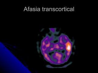 Afasia transcortical 