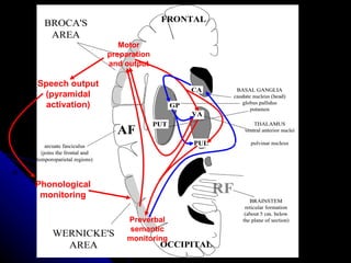 Preverbal semantic monitoring Motor preparation and output Speech output (pyramidal activation) Phonological monitoring 