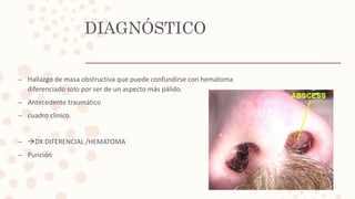 Afecciones del septum nasal  Slide 28