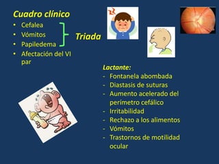 Cuadro clínico
• Cefalea
• Vómitos
• Papiledema
• Afectación del VI
par
Lactante:
- Fontanela abombada
- Diastasis de suturas
- Aumento acelerado del
perímetro cefálico
- Irritabilidad
- Rechazo a los alimentos
- Vómitos
- Trastornos de motilidad
ocular
Triada
 