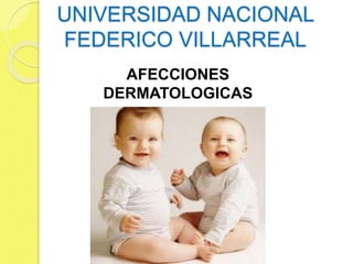 UNIVERSIDAD NACIONAL
FEDERICO VILLARREAL
AFECCIONES
DERMATOLOGICAS
 