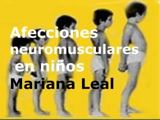 Afecciones
neuromusculares
en niños
Mariana Leal
 