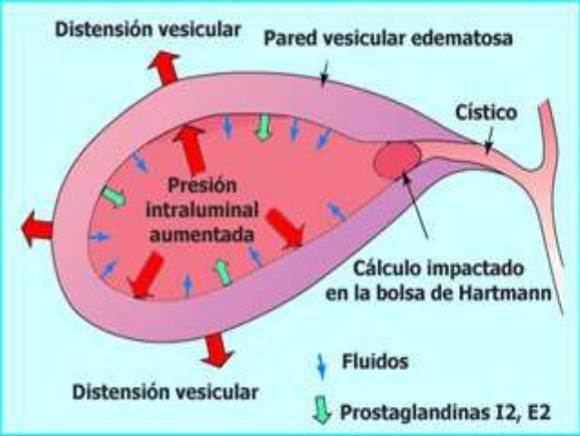Afecciones Quirúrgicas Y Embarazo