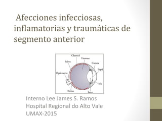 Afecciones infecciosas,
inflamatorias y traumáticas de
segmento anterior
Interno Lee James S. Ramos
Hospital Regional do Alto Vale
UMAX-2015
 