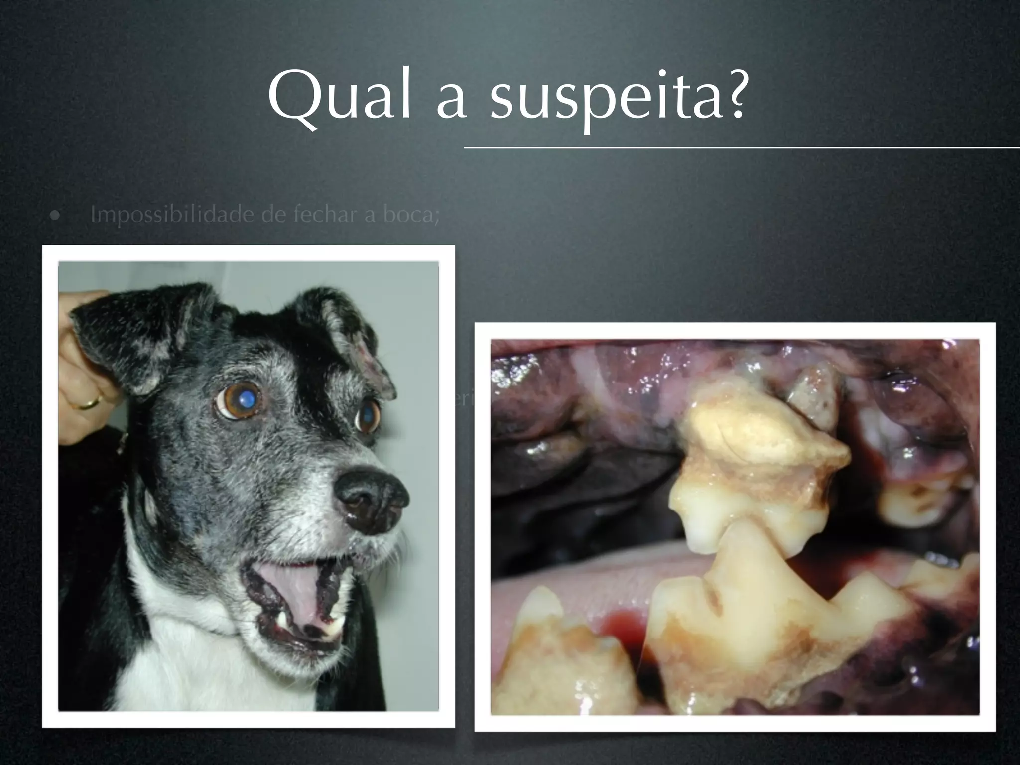 Qual a suspeita?
• Impossibilidade de fechar a boca;
• Flacidez à palpação
• Salivação
• Halitose
• Nenhum histórico de tratamento periodontal
 