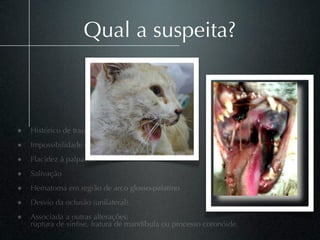 Qual a suspeita?



• Histórico de trauma;
• Impossibilidade de fechar a boca;
• Flacidez à palpação
• Salivação
• Hematoma em região de arco glosso-palatino
• Desvio da oclusão (unilateral).
• Associada a outras alterações:
    ruptura de sínﬁse, fratura de mandíbula ou processo coronóide.
 