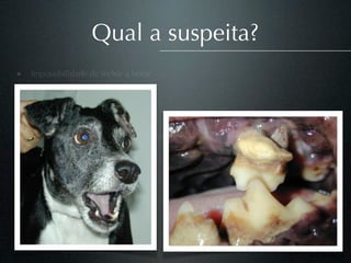 Qual a suspeita?
• Impossibilidade de fechar a boca;
• Flacidez à palpação
• Salivação
• Halitose
• Nenhum histórico de tratamento periodontal
 
