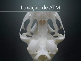 Luxação de ATM
 