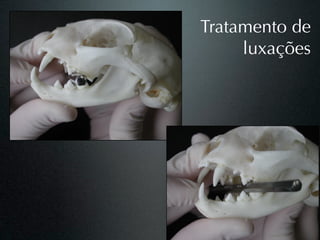 Tratamento de
     luxações
 