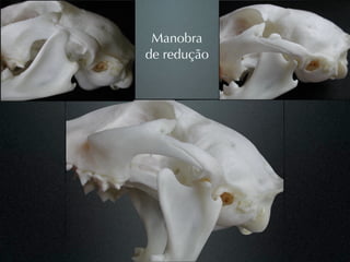 Manobra
de redução
 